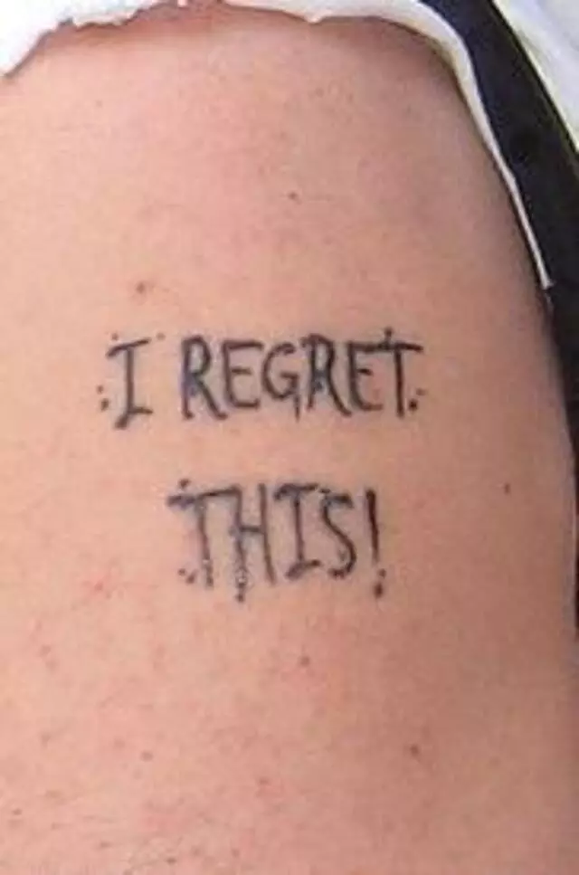 Anticipation Tattoo Removal