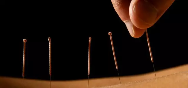 Anna Veronesi Acupuncture and Massage Biomagnetism