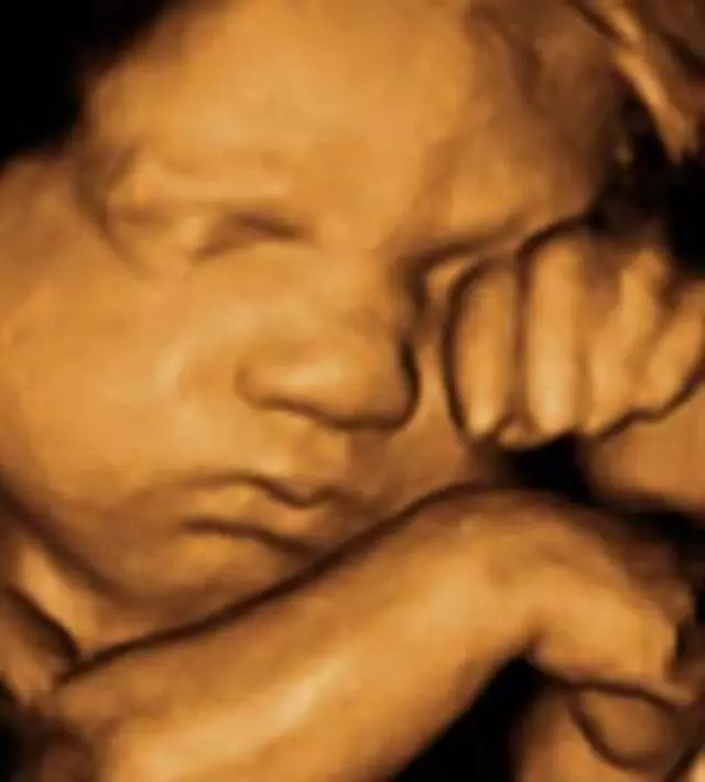 Anticipation Ultrasound Studio