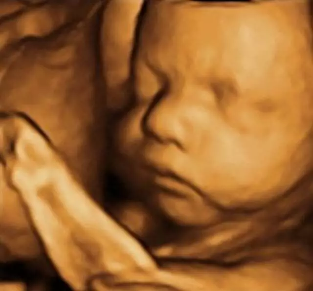 Anticipation Ultrasound Studio