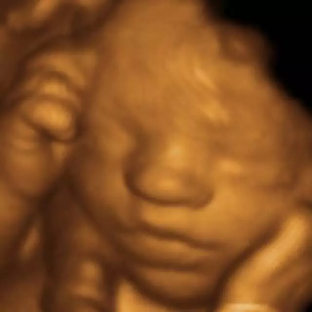 Anticipation Ultrasound Studio