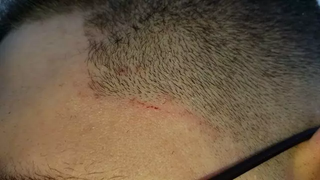 Fade Tite
